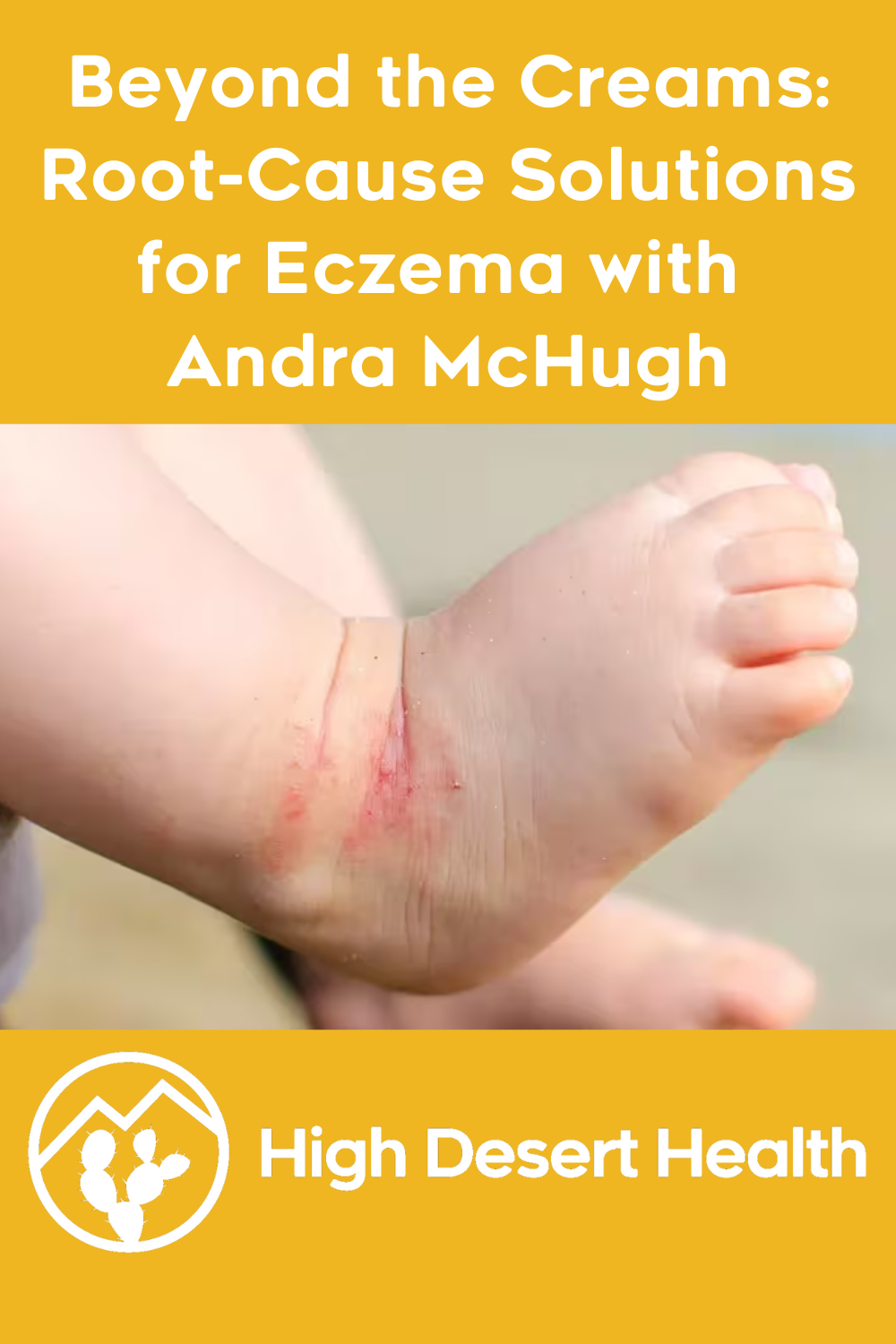Beyond the Creams: Root-Cause Solutions for Eczema with Andra McHugh