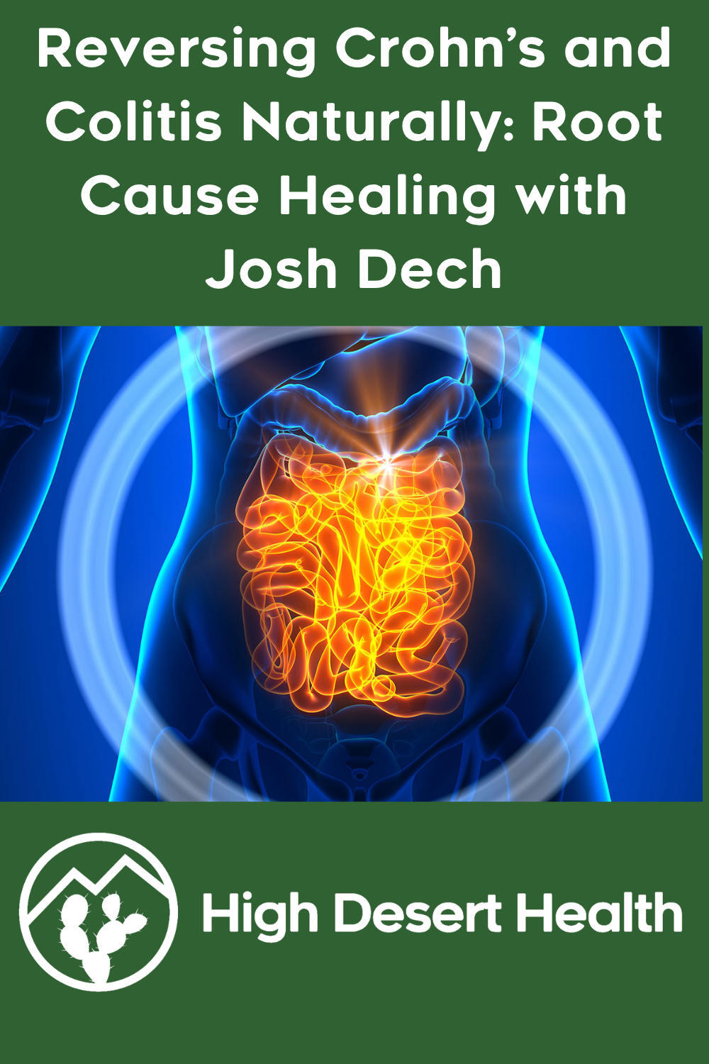 Reversing Crohn’s and Colitis Naturally: Root Cause Healing with Josh Dech