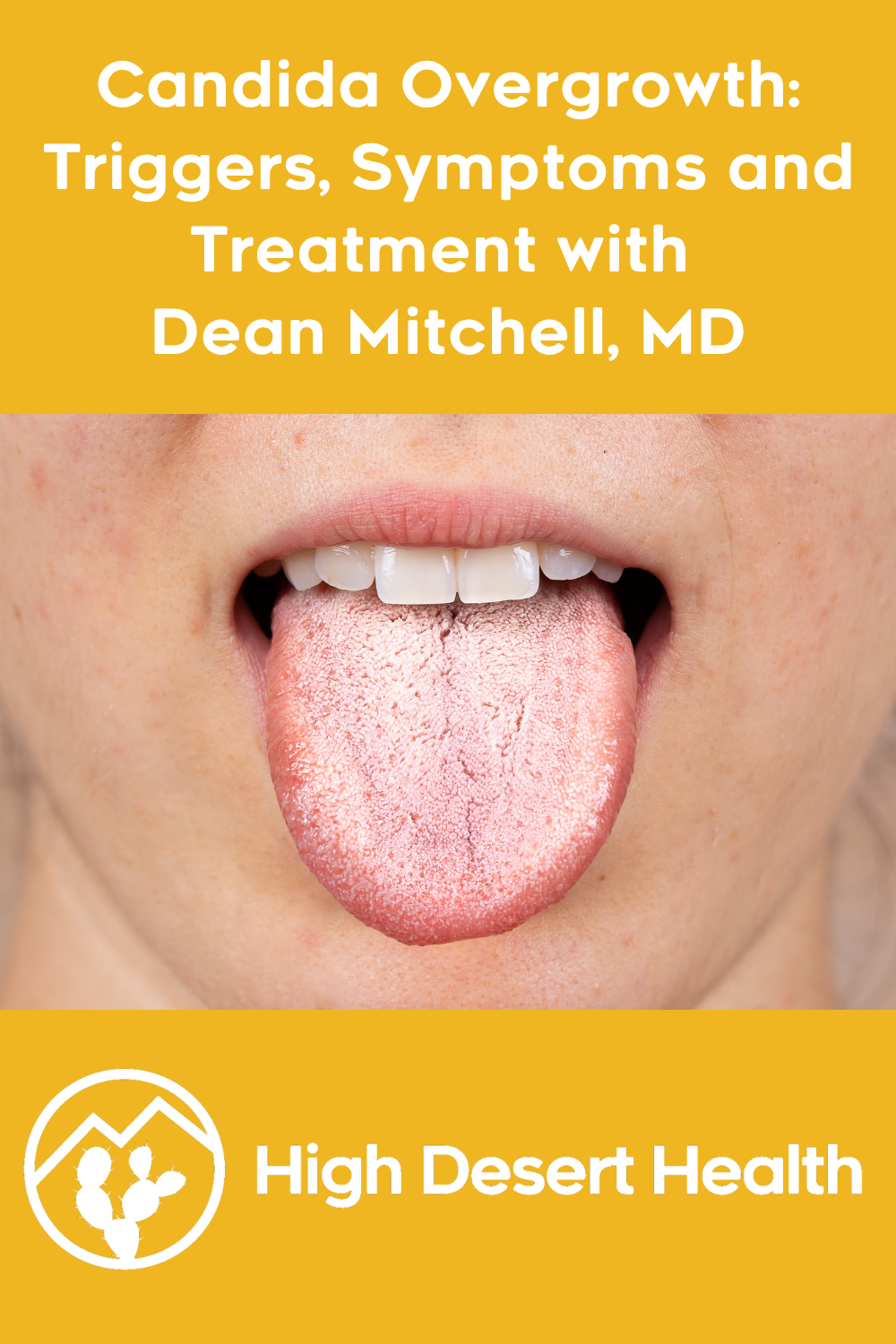 Candida Overgrowth: Triggers, Symptoms and Treatment with Dean Mitchell, MD
