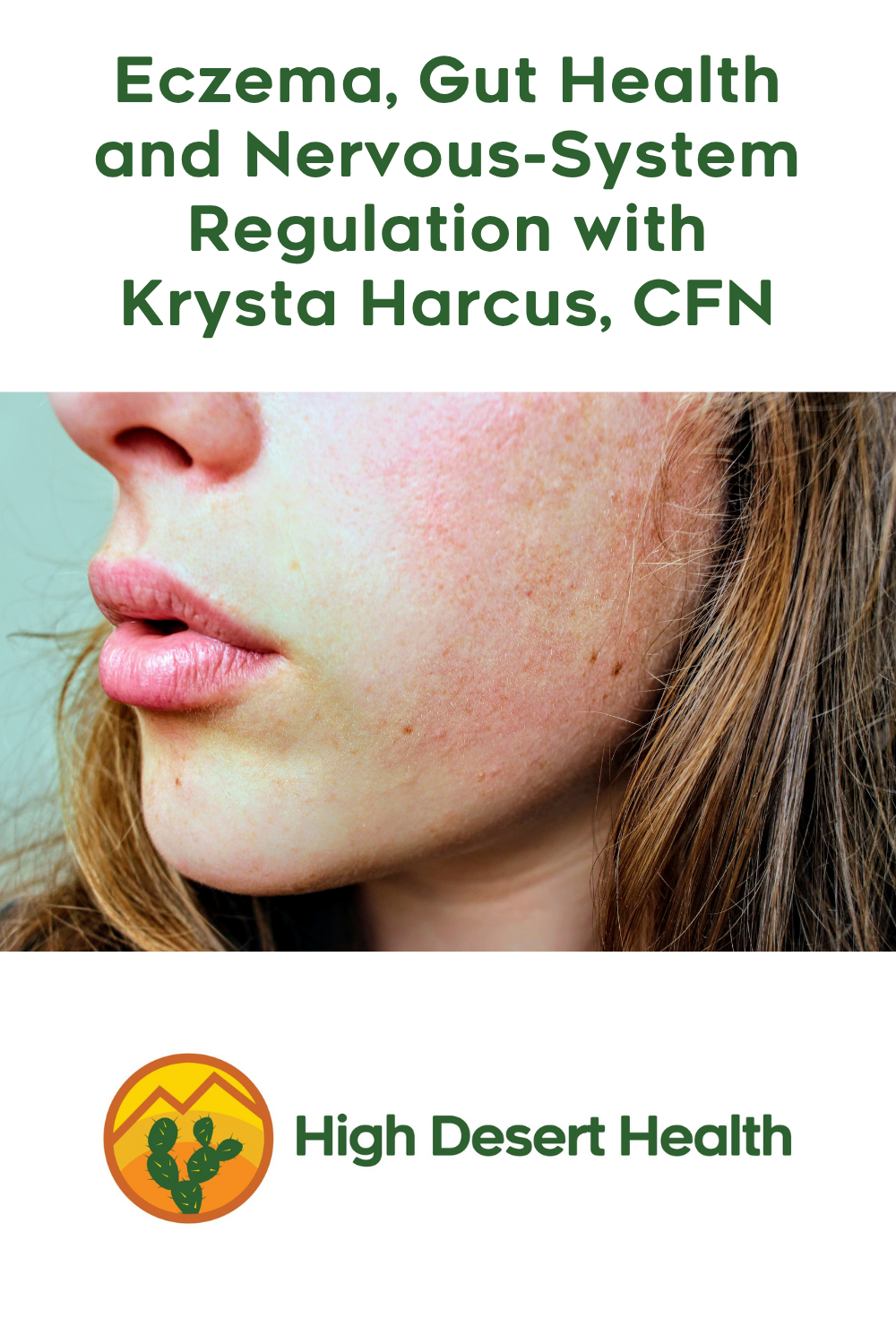 Eczema, Gut Health and Nervous-System Regulation with Krysta Harcus, CFN